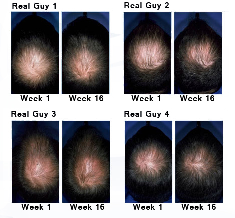 Rogaine Result